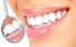 Implanty zębowe, jakie wybrać?