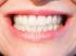 Nić dentystyczna – najważniejsze informacje