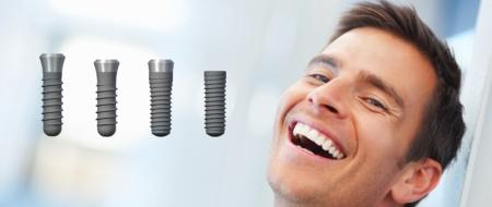 Czynnik finansowy jest wciąż główną przeszkodą dla pacjentów rozważających implanty zębowe.