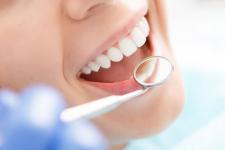 Dlaczego regularne wizyty u stomatologa są ważne?
