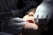 Zalety implantów dentystycznych