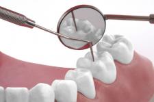 Kompleksowe leczenie zębów pod jednym dachem