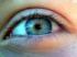 Choroby oczu : wytrzeszcz oka, jęczmień, jaskra i zez (choroba zezowa).