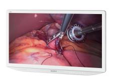 Premiera technologii 4K firmy Sony w segmencie urządzeń medycznych