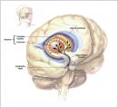 Witamina D a choroba Parkinsona