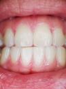 Czym zajmuje się periodontologia?